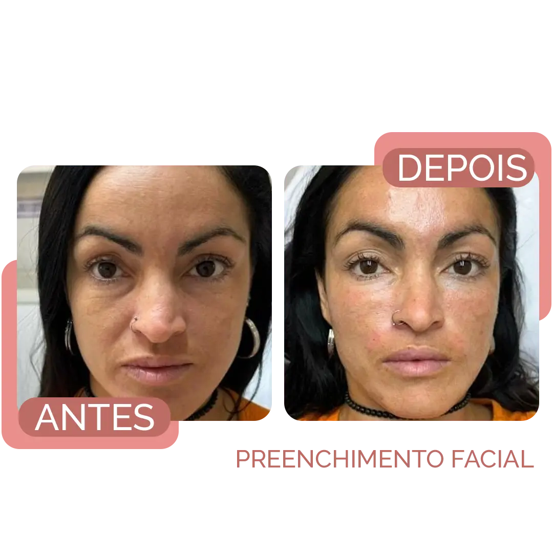 bumbum na nuca recife